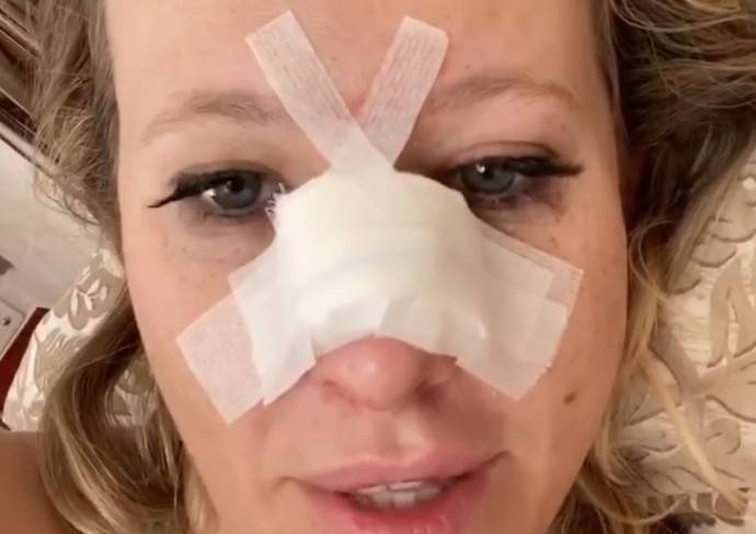После череды скандалов Ксения Собчак оказалась в больнице со сломанным носом
