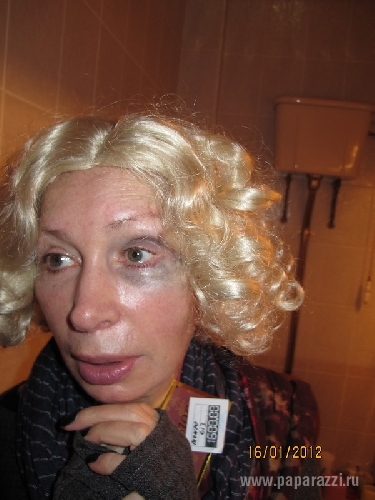 В интернете появились фото Татьяны Васильевой с синяком под глазом