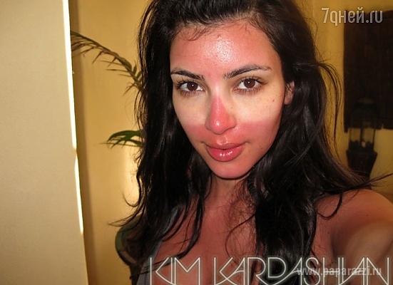 Ким Кардашьян сгорела на солнце