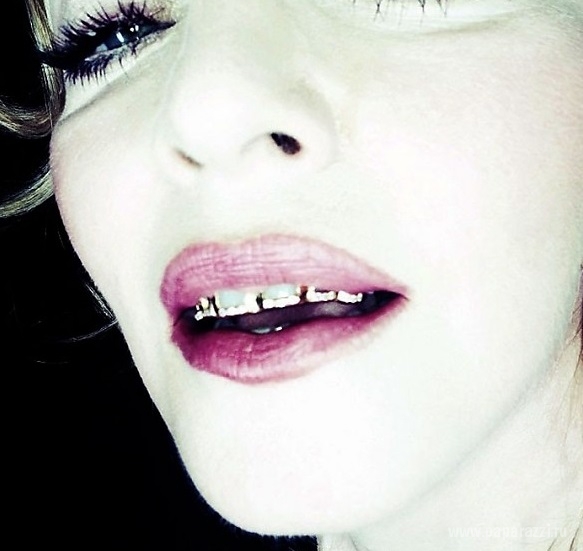 Мадонна украсила зубы бриллиантами и золотом