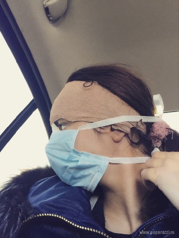 Алиана Устиненко-Гобозова решила лечь под нож пластического хирурга