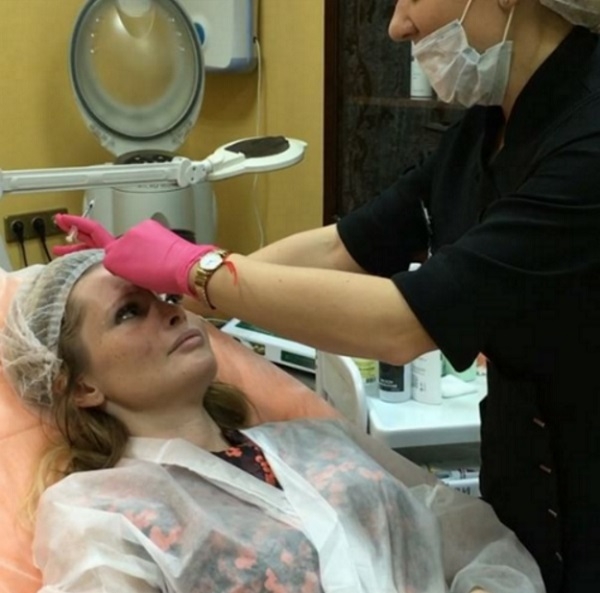 Дана Борисова отрабатывает зарплату, снимаясь в роликах пластической хирургии