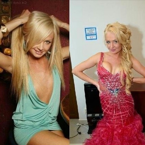 Дарья пынзарь фото до и после пластики фото