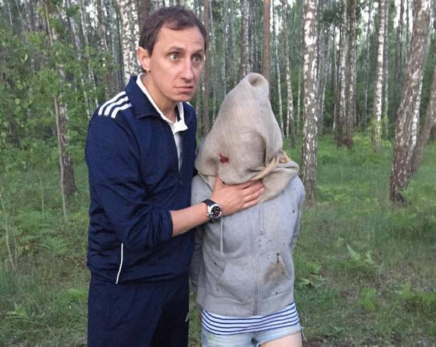 Вадим Галыгин шокировал, показав обезображенное лицо