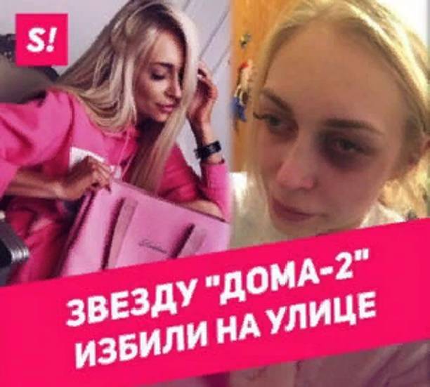 После жестокого нападения бывшего парня, Кристина Дерябина попросила помощи и поддержки