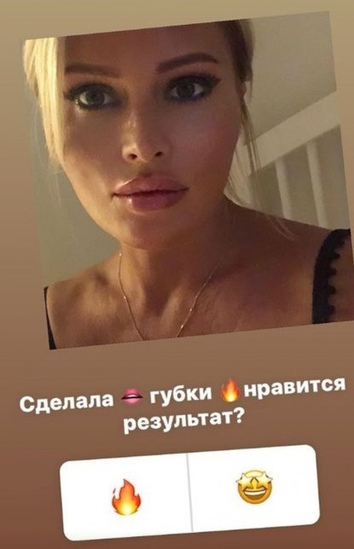 Дана Борисова накачала себе по бартеру губы