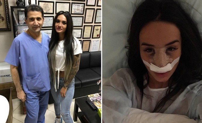 "Вы ещё больше добиваете": подруга Марины Мексики пожалела её после очередной неудачной пластики носа