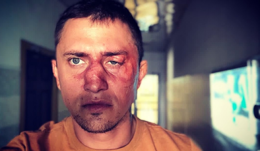Павел Прилучный вернулся к съёмкам после пластической операции