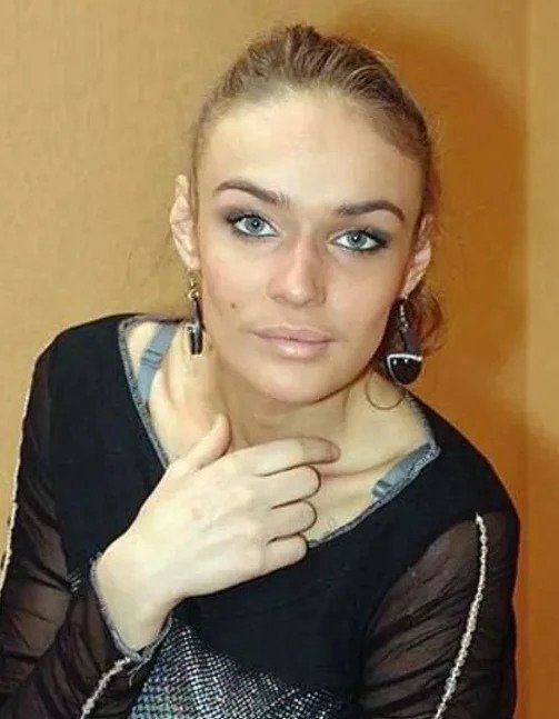 Алена Водонаева призналась, что ведет борьбу с растущими усами