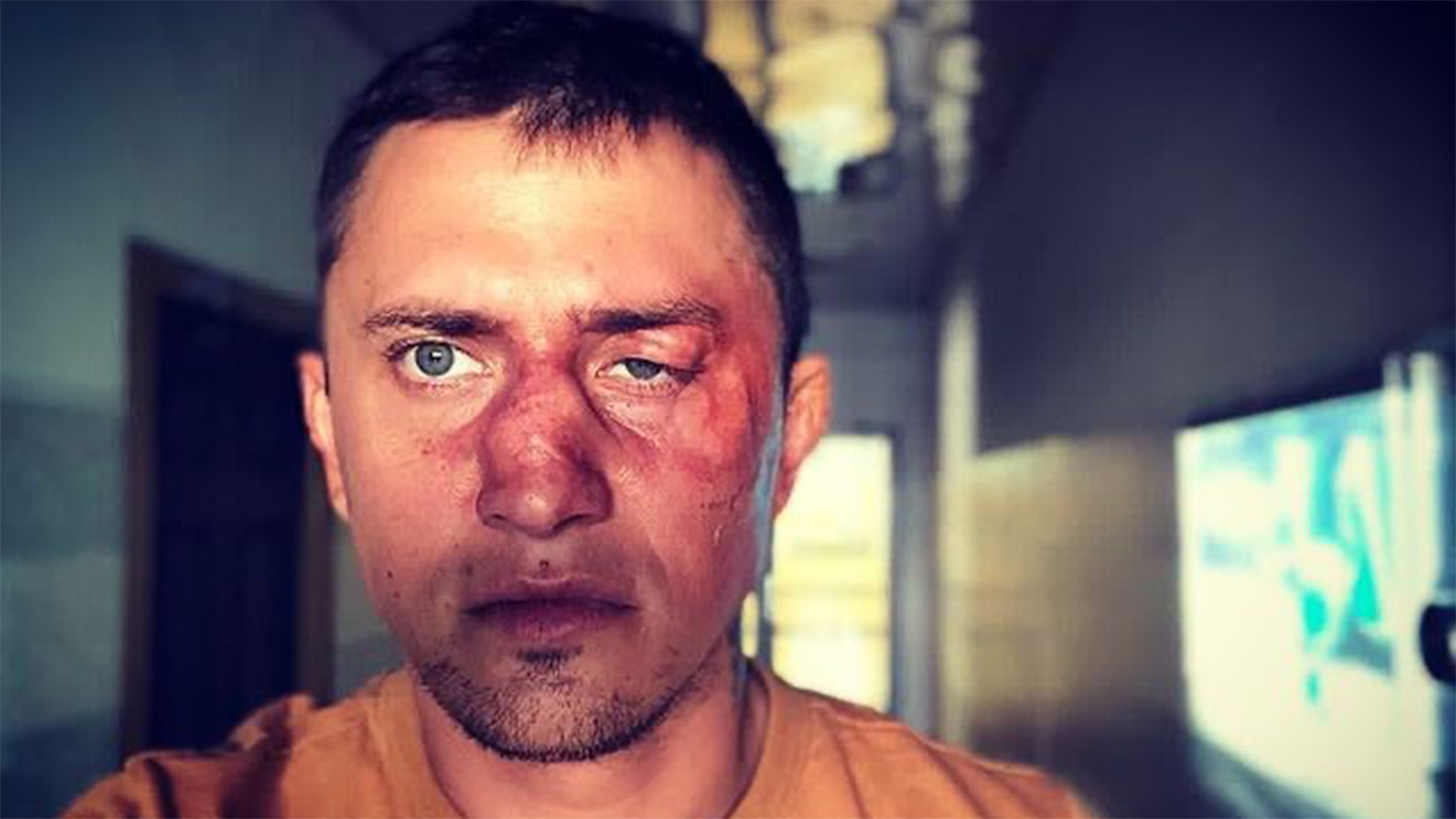 Бизнесмен, подравшийся с Павлом Прилучным, уверяет, что не избивал актера
