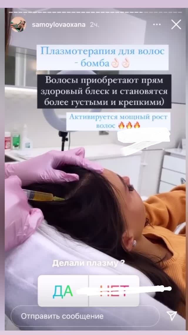 Уколы в голову: Оксана Самойлова показала кадры своих жутких бьюти-процедур