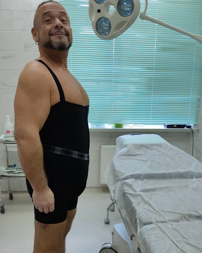 Феноменально похудевший комик Александр Морозов решил жениться и показал, как выглядит после пластической операции