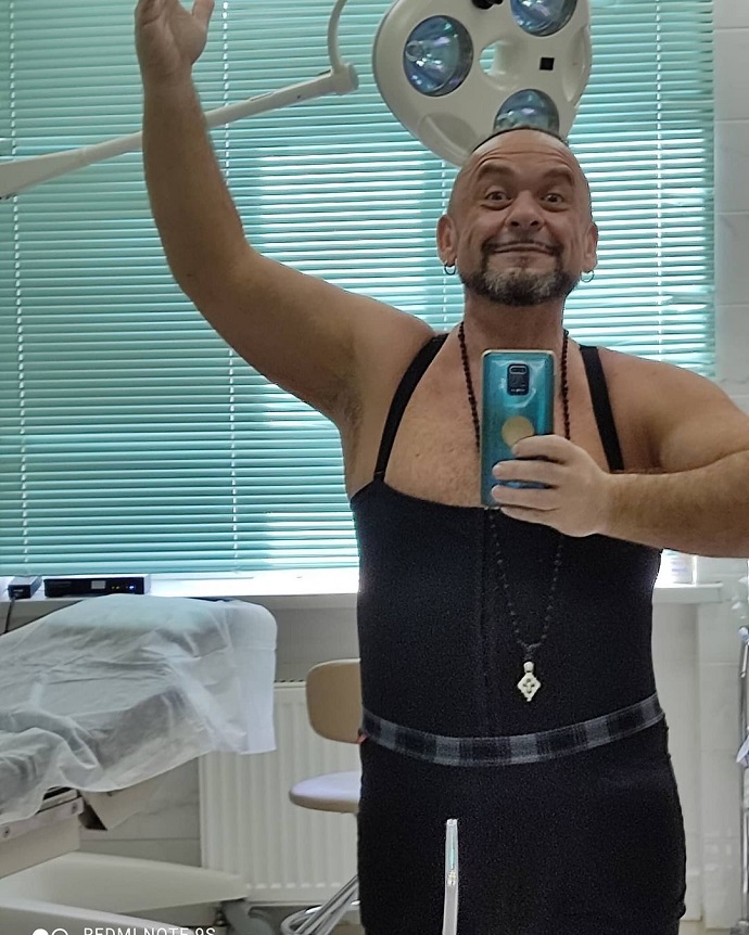 Феноменально похудевший комик Александр Морозов решил жениться и показал, как выглядит после пластической операции
