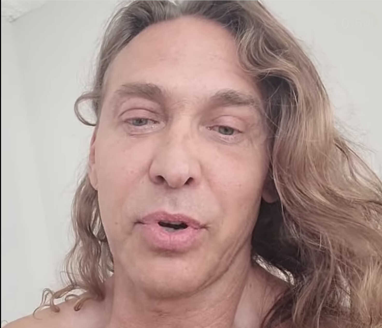 51-летний Сергей Глушко показал, как делает уколы красоты и лифтинг