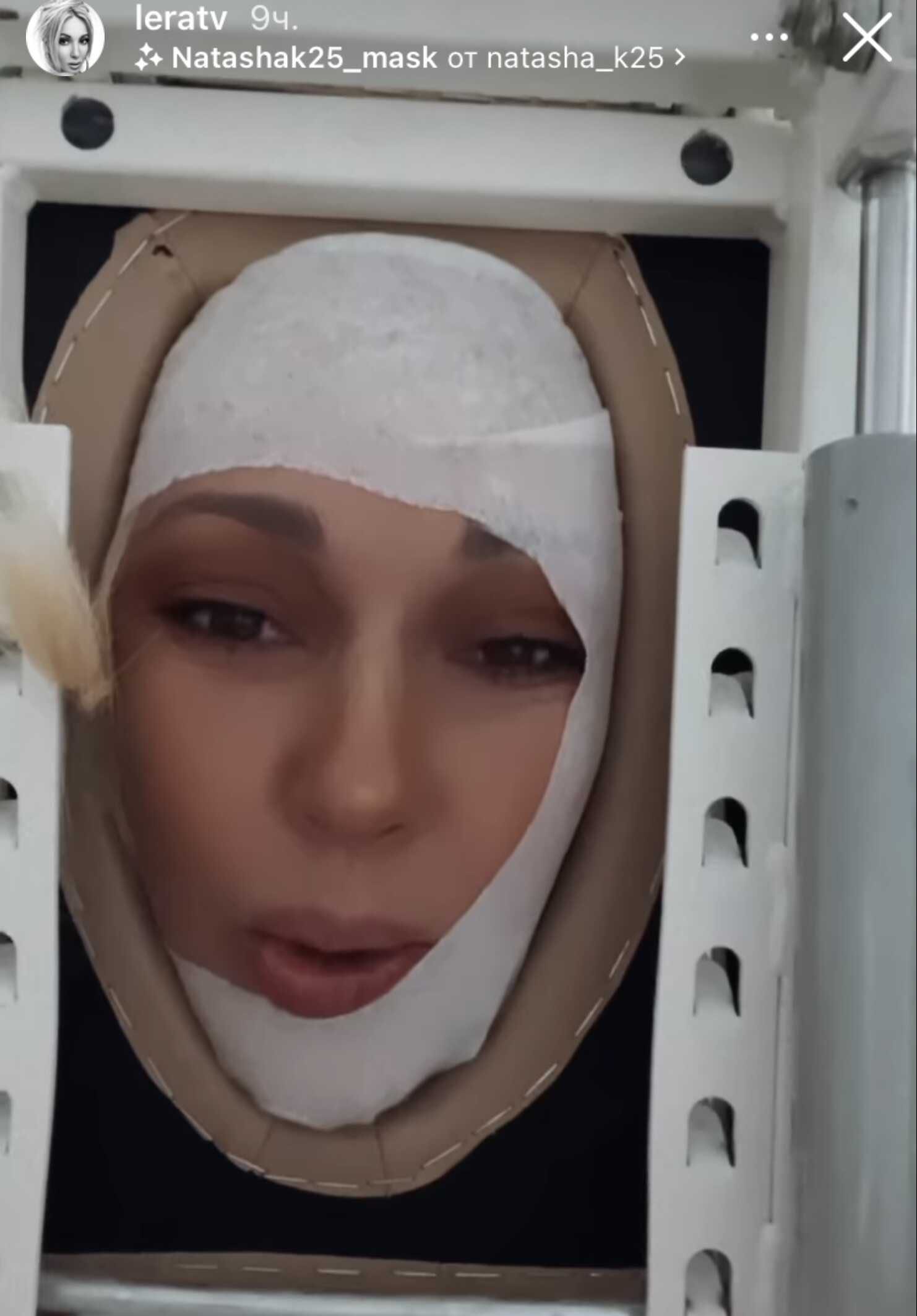 Лера Кудрявцева попала в больницу после съёмок «Песни года»