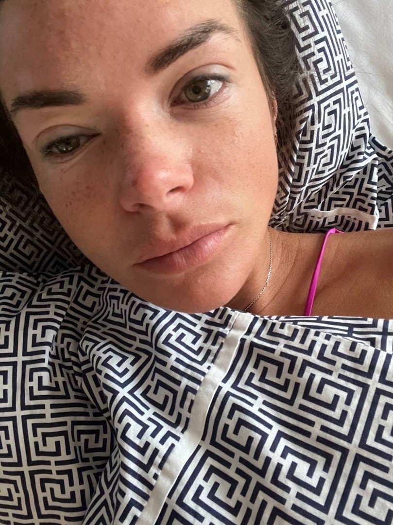 Катя Жужа показала лицо, изуродованное косметологической процедурой