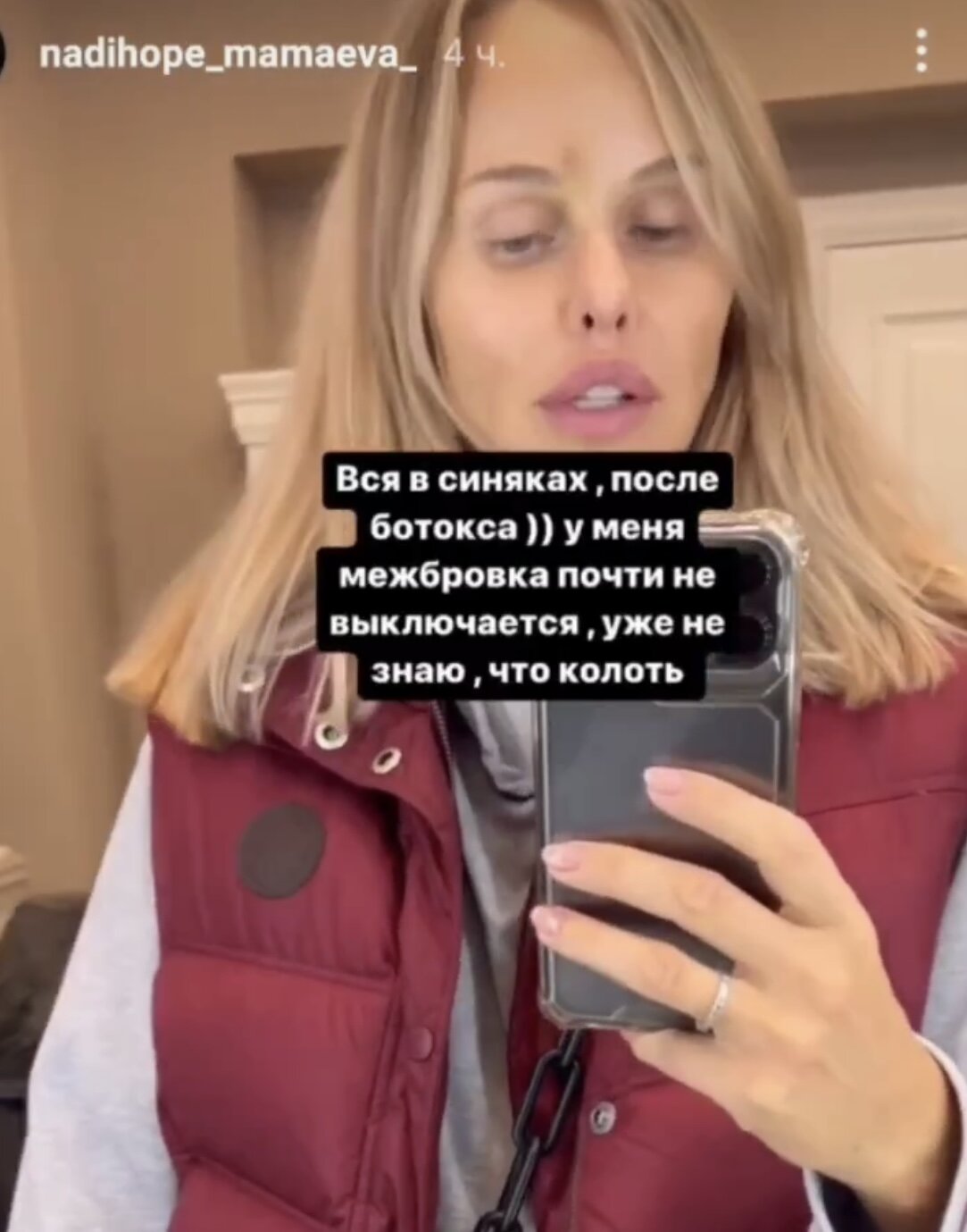 Даже ботокс не помогает: пластиковая жена Павла Мамаева показала себя без фильтров и уже не знает, что ещё вколоть в лицо