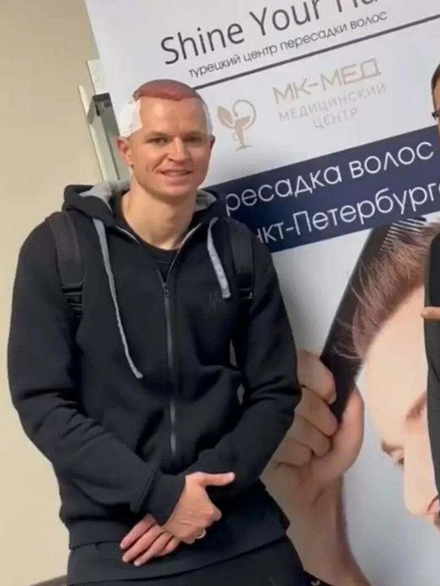 «Длилось 8 часов»: Дмитрий Тарасов перенёс операцию и поделился не самыми приятными кадрами