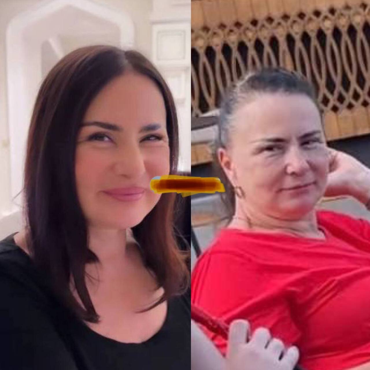 Оксана Самойлова до и после пластики - фото на PEOPLETALK