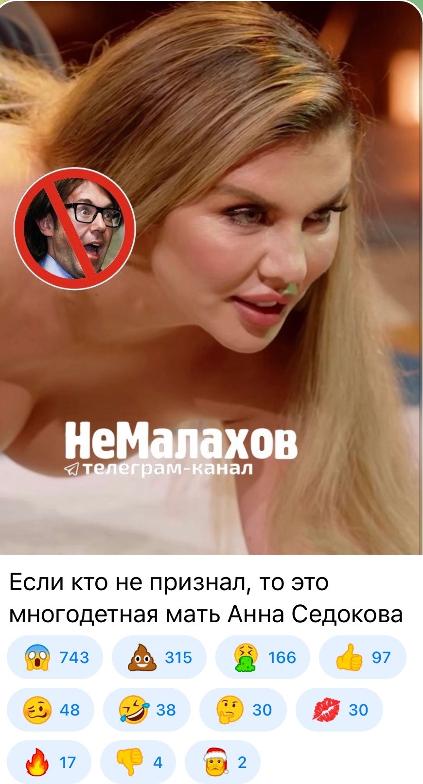 "Не буду никуда выходить": Анна Седокова заявила, что набрала вес из-за лекарств
