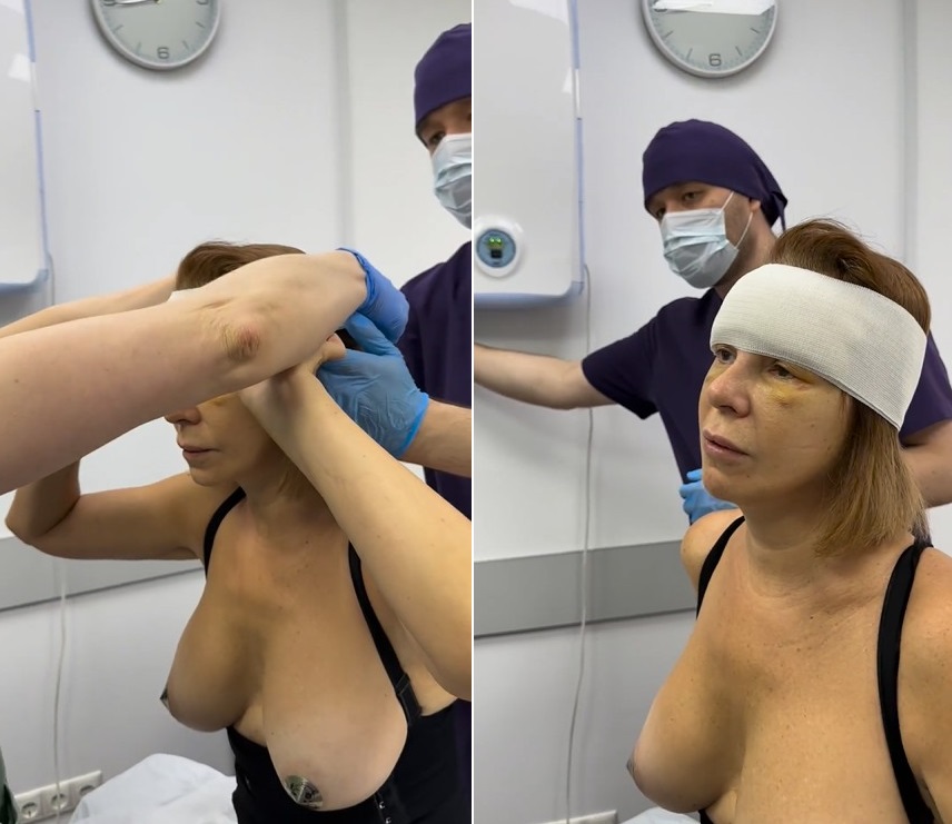 Сразу после пластической операции Наталья Штурм показала свою грудь, а теперь еще и попу