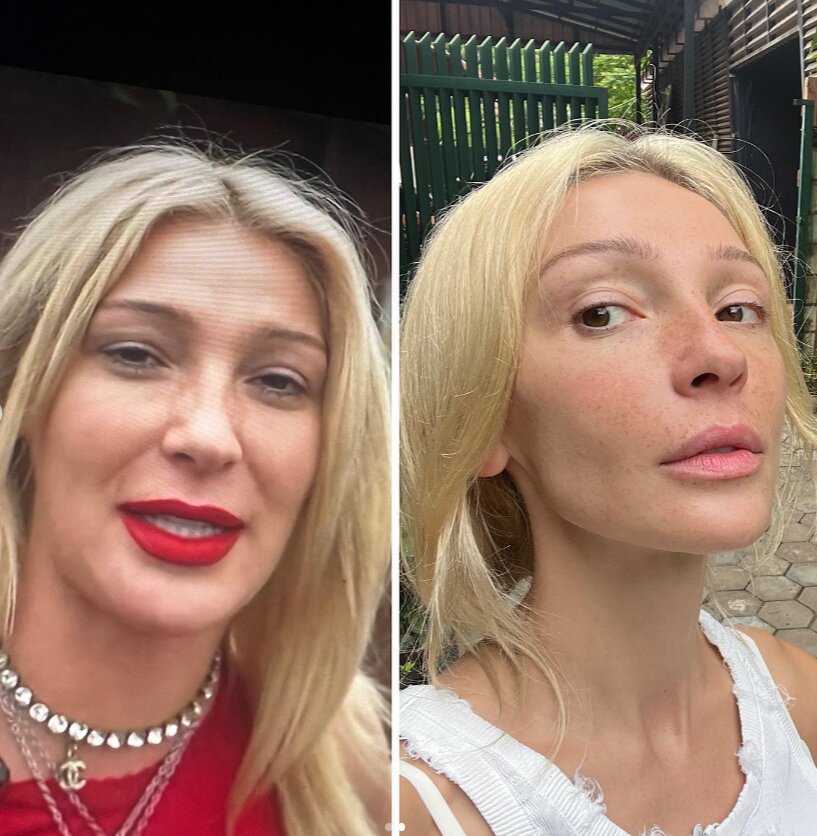 «Нехило разожралась»: Настя Ивлеева похудела на 14 килограмм и показала фото До и После. Разница впечатляет