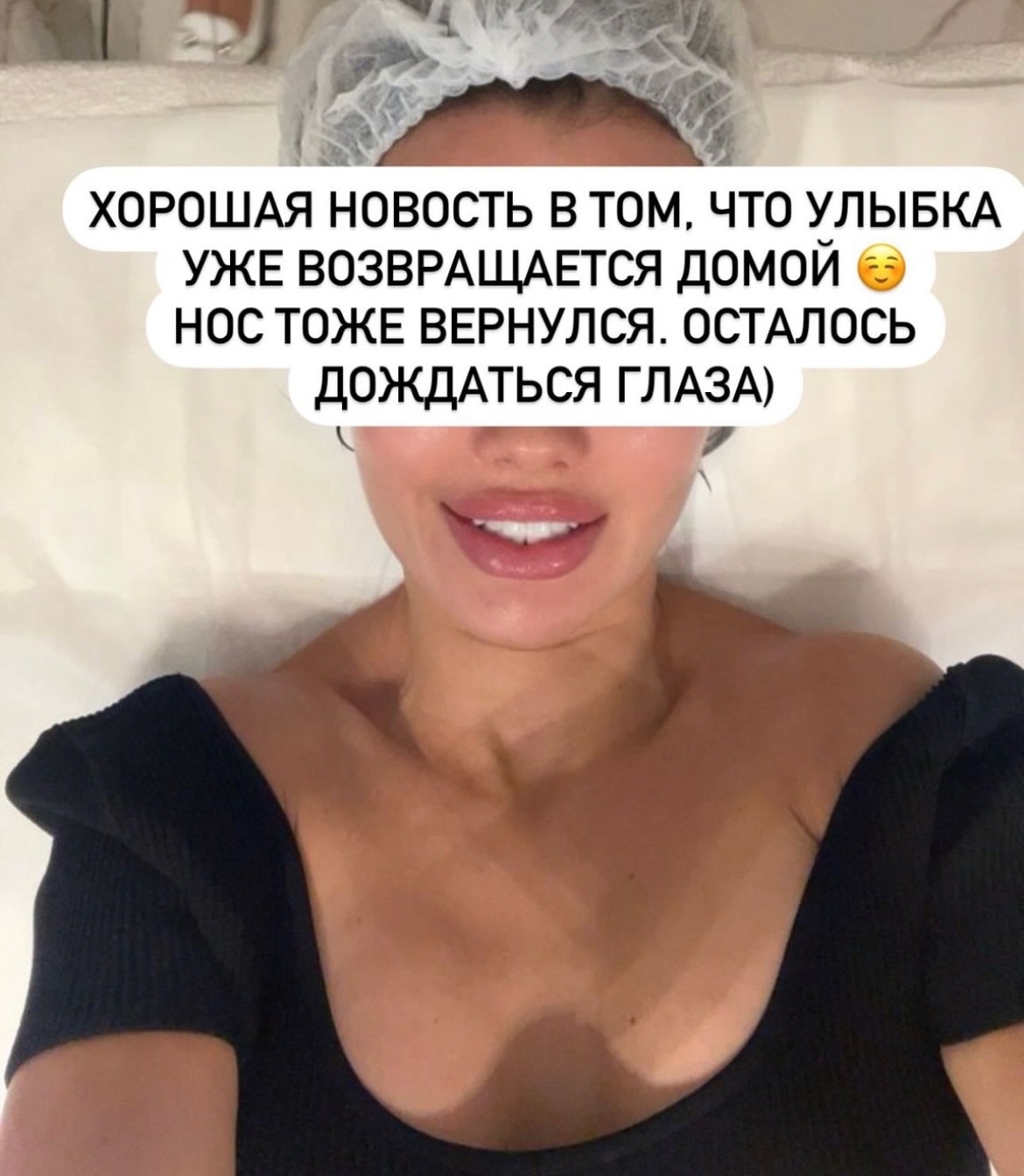 "Хорошая новость": Виктория Боня заявила, что ее лицо восстанавливается после пластики 

