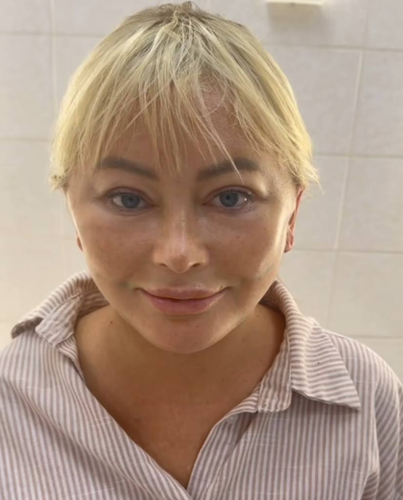 Дана Борисова показала результат очередной пластической операции