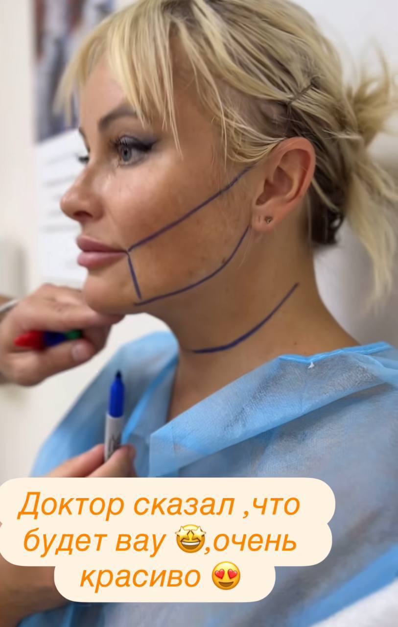 Дана Борисова показала результат очередной пластической операции